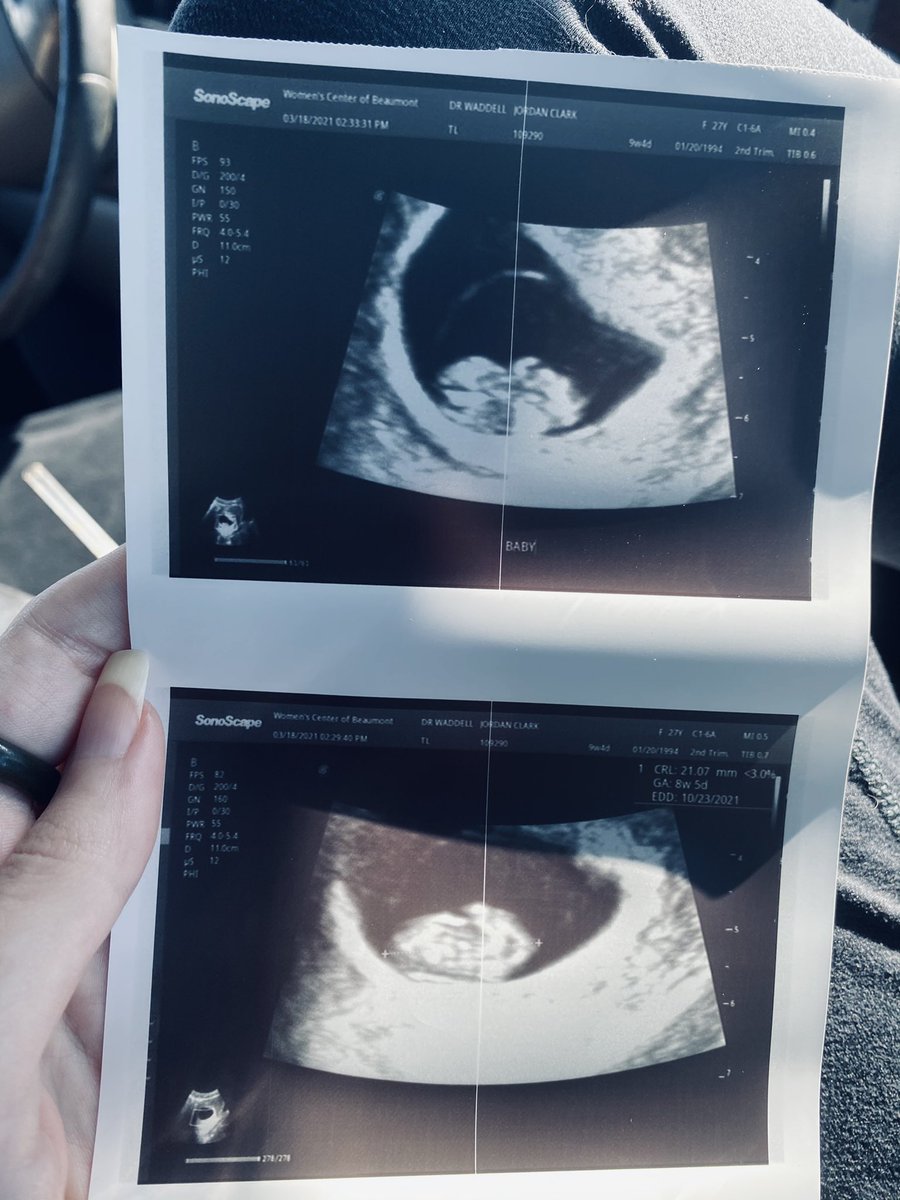 ๐๐๐๐ฅ โ๐ฃ๐๐๐ฅ๐ช ๐๐๐ฅ๐๐ ๐๐ฎ tweet media