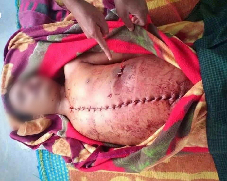 shafiur's tweet photo. #Myanmar

KILLED IN FRONT OF HIS DAUGHTER by SAC Junta. 

 In Magway on 29 March when riding a motorbike along with his younger brother. Body returned in this state yesterday. CHEST AND ABDOMEN OPENED. 

#WhatsHappeningInMyanmar https://t.co/WsDNoczEaY