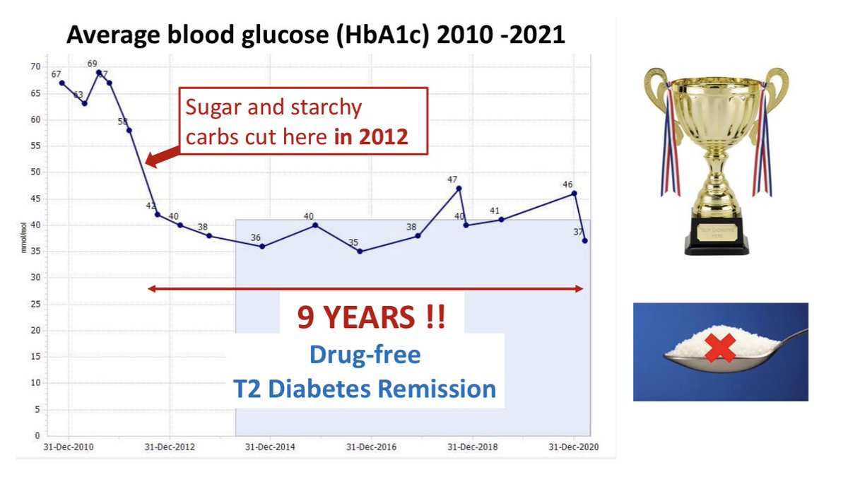 lowcarbGP's tweet photo. But is low carb sustainable? Yes it is 👍 Look at this case NINE YEARS OF DRUG FREE T2 DIABETES REMISSION Also weight loss and improved lipid profile into the bargain This person is not a patient anymore 😀 If one person can do this so can others. A beacon of #HOPE https://t.co/u2LQDI0xkq