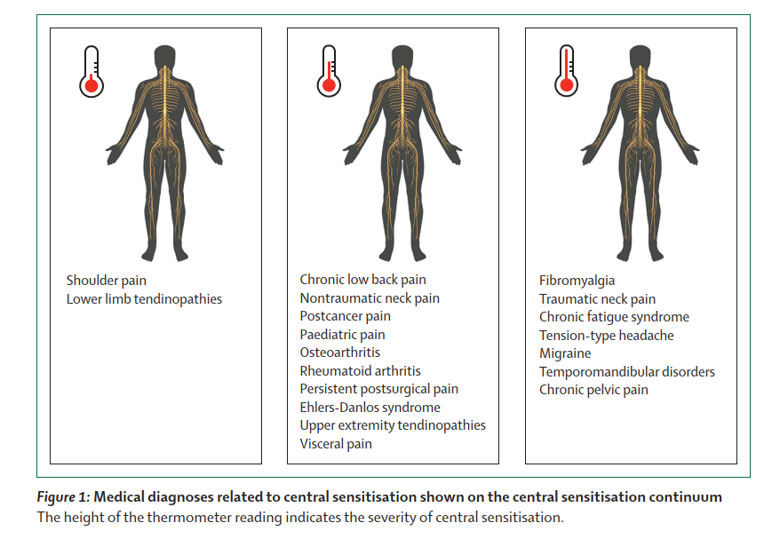 PhysioMeScience's tweet photo. Just published ๐ฅ๐ฅ๐ฅ
Central sensitisation in chronic pain conditions: latest
discoveries and their potential for precision medicine
๐๐๐๐
https://t.co/1SGld5p4Sb https://t.co/7ZsG3a38zj