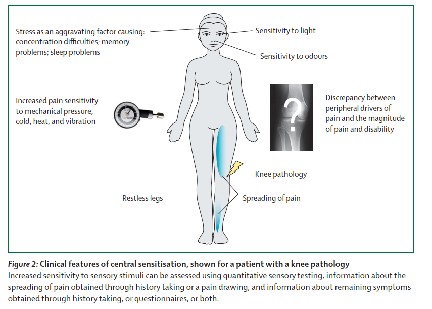 PhysioMeScience's tweet photo. Just published ๐ฅ๐ฅ๐ฅ
Central sensitisation in chronic pain conditions: latest
discoveries and their potential for precision medicine
๐๐๐๐
https://t.co/1SGld5p4Sb https://t.co/7ZsG3a38zj