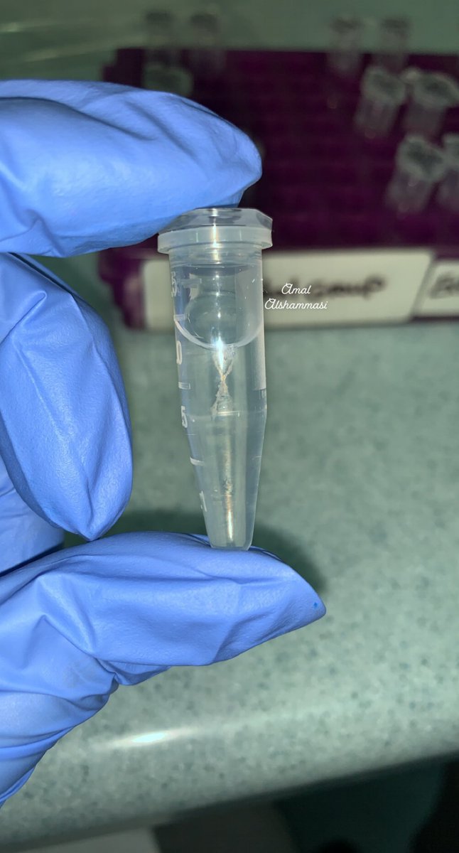 Isn’t it pretty?🧬😍 DNA visible after extracting it from Chorionic Villus sample for prenatal diagnostic #DNA #moleculargenetics #prenatal #genetics