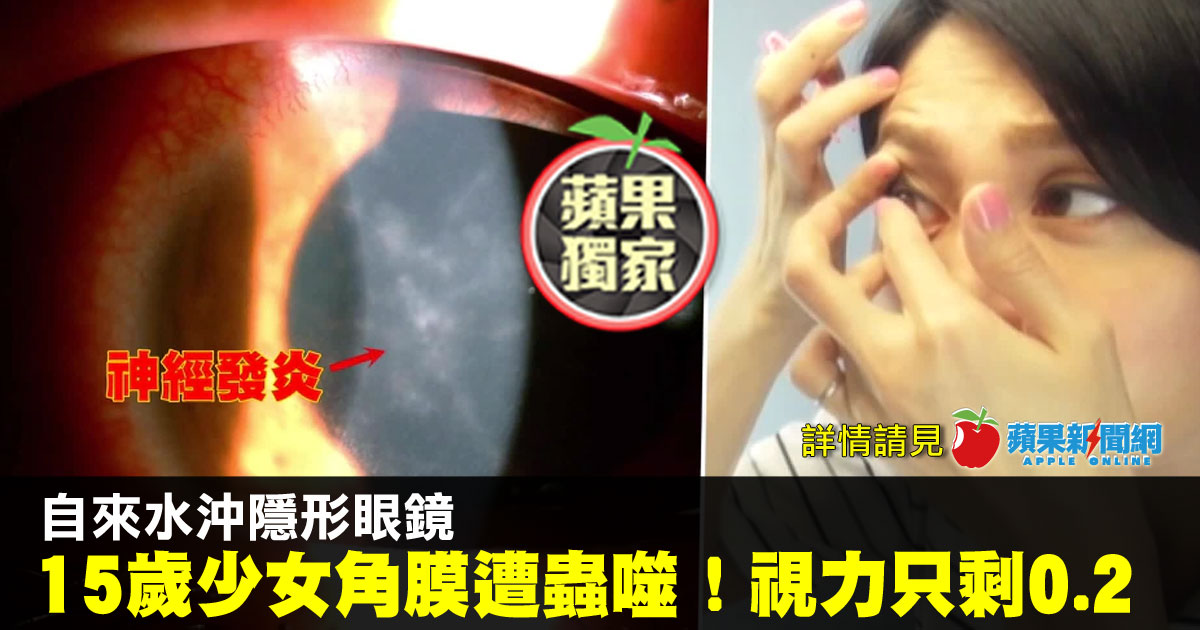 隱形眼鏡 Twitter Search 隱形眼鏡 Twitter Search