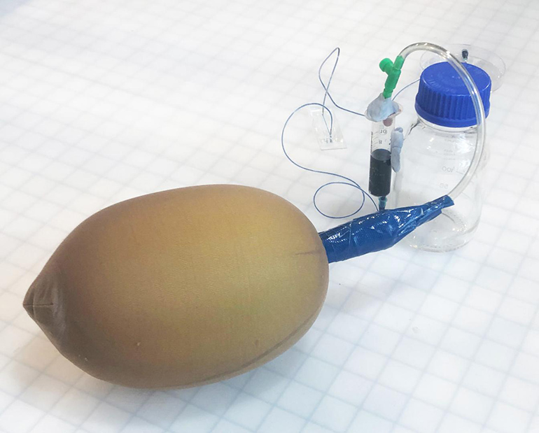 bioce11's tweet photo. $2 DIY Microfluidics pump from Balloons and Nylon Stockings.  One step closer! 
https://t.co/SN8AQhXZjq

#BioTech #BioMed #TissueEngineering #Biofabrication #Microfluidics https://t.co/1kdUQsy5Kb
