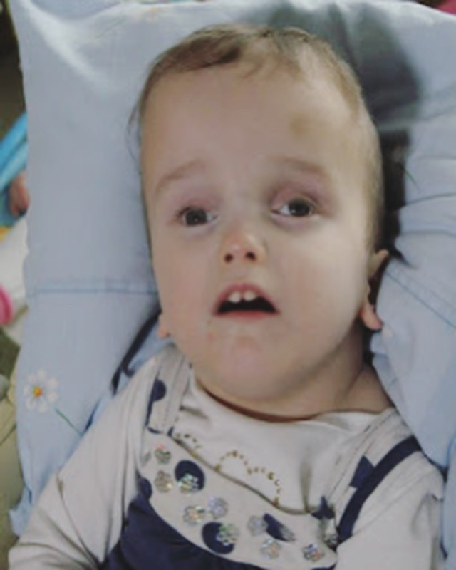 ReecesRainbow's tweet photo. Beautiful Joanna has been waiting for years. She needs a family who will love her and get her the medical attention she needs. Check out the video link in her profile!
https://t.co/tuqTcZXAeb
#adopt #adoptionrocks #specialneedsadoption #buildalongertable #hydrocephalus https://t.co/GC6iTb76hE