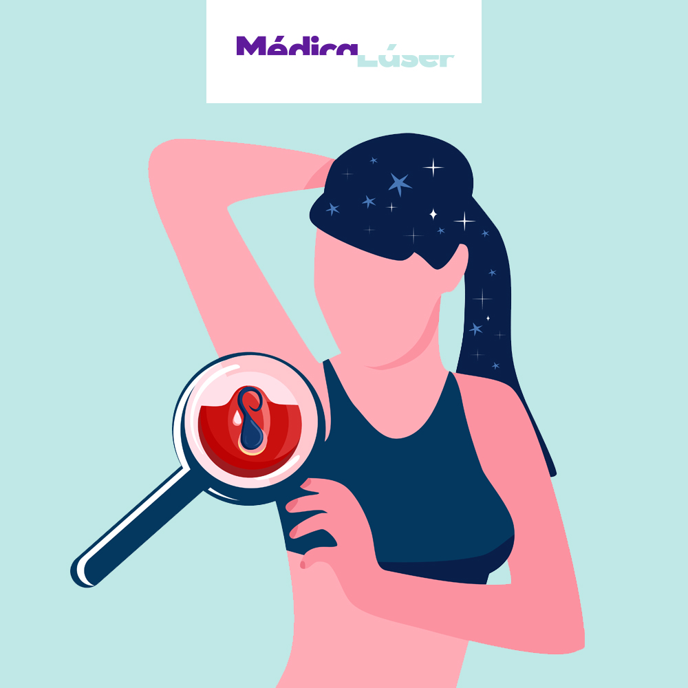 La foliculitis puede afectar tanto a mujeres como hombres y consiste en la inflamación de los folículos pilosos de nuestro cuerpo, causando dolor. La mayoría de dermatólogos recomiendan la depilación láser como una de las primeras líneas de actuación 🧐.