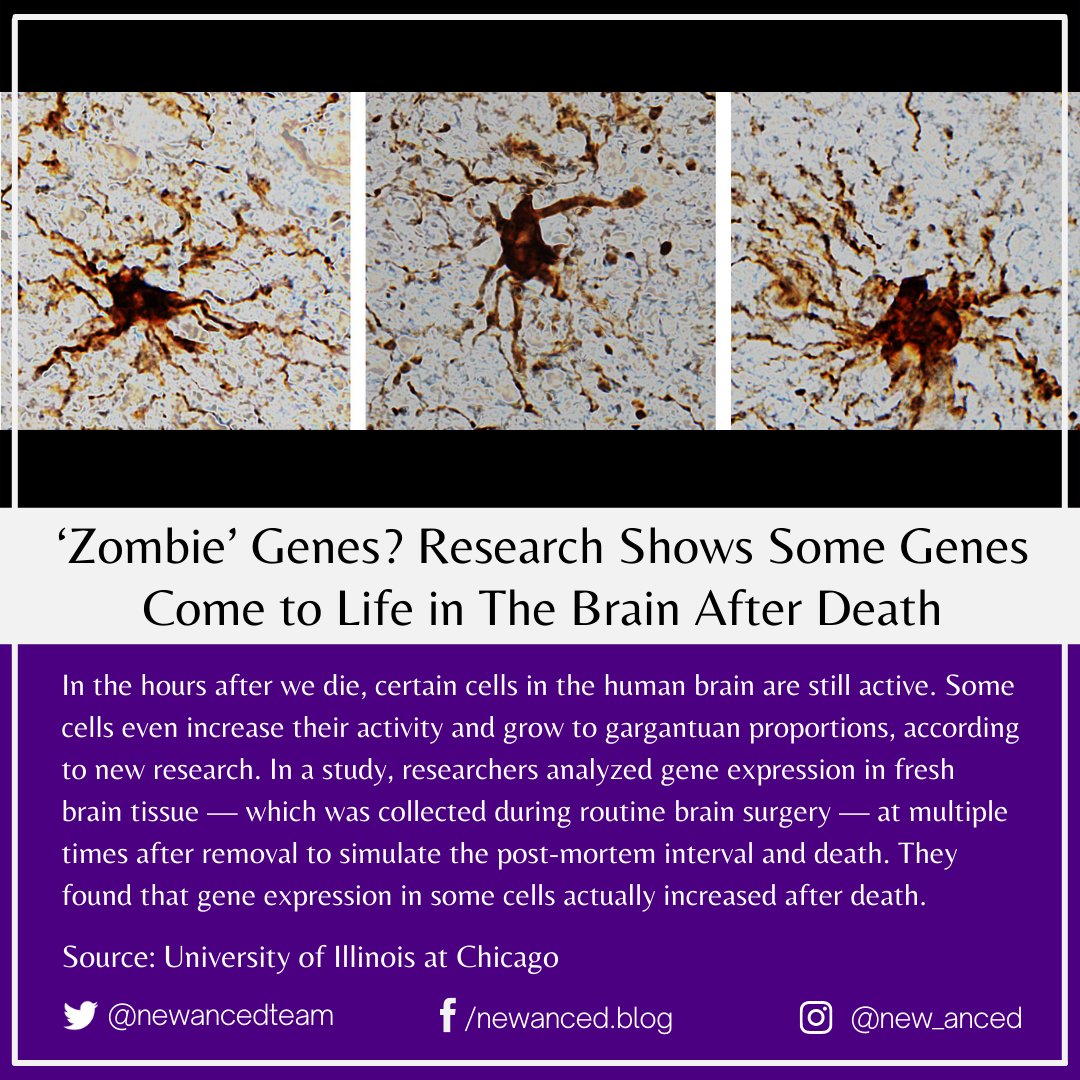 sciencenstuf's tweet photo. ‘Zombie’ Genes? Research Shows Some Genes Come to Life in The Brain After Death

Source: University of Illinois at Chicago

📷 Dr. Jeffrey Loeb/UIC

#health #zombiegenes #genes #brain #death #humancells #braintissue #cells #universityofillinoisatchicago

https://t.co/3kp4uX44fG https://t.co/luGMsuGRNS