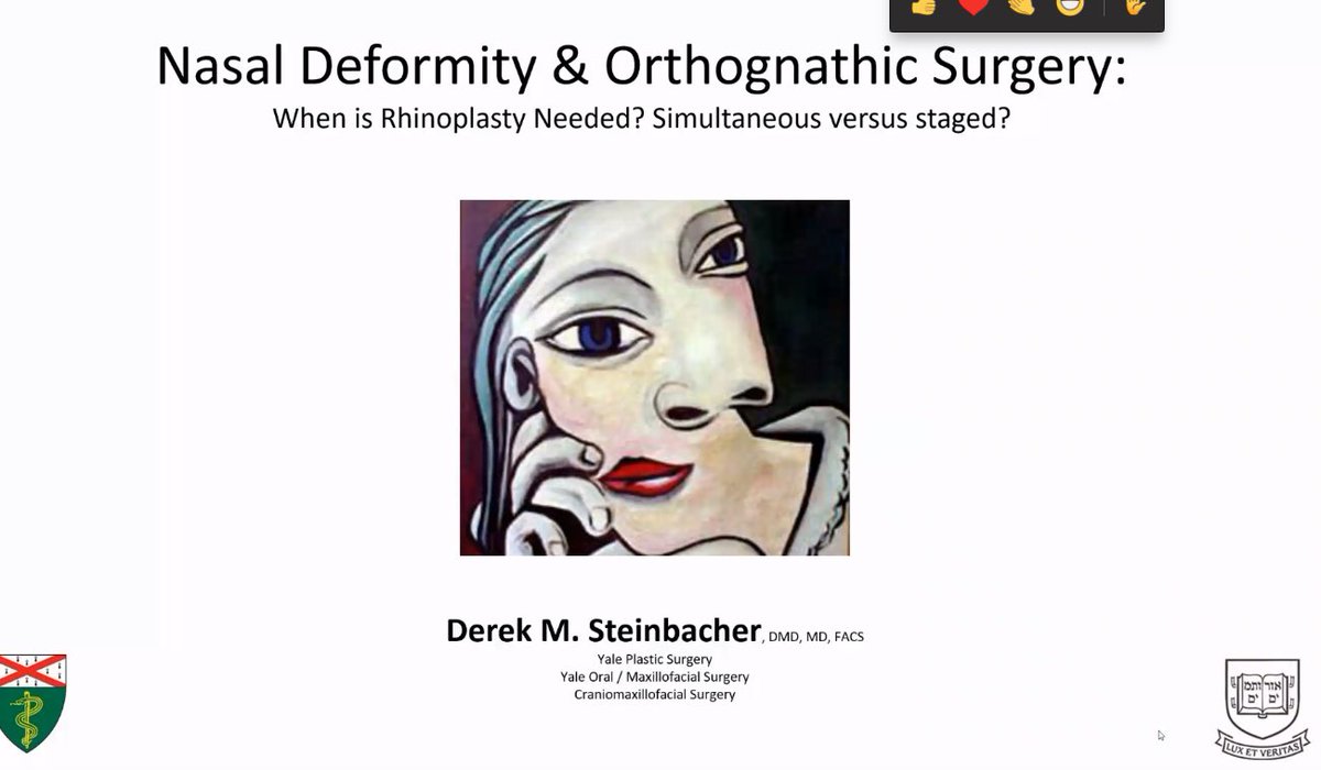 CleClinicHNI's tweet image. Thanks @SteinBeastMD for sharing your knowledge of nasal deformity &amp;amp; Orthognathic Surgery with us at Grand Rounds! @Yale_ENT ccf.org/headnecklive