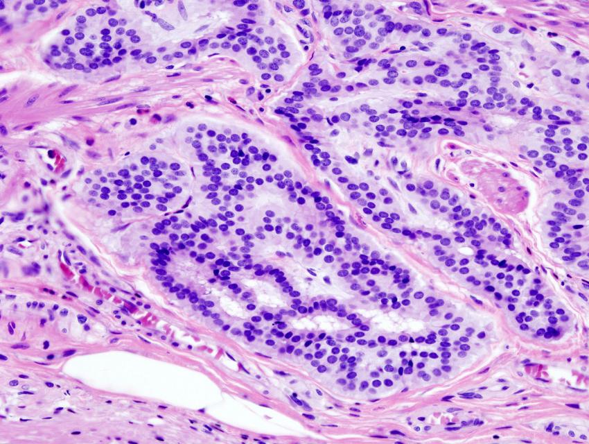 e_dendrite's tweet photo. Breaking: Bariatric surgery can reduce cancer risk by almost 50% according to latest studies. 
https://t.co/bd2uKmZY8s
#obesity #health https://t.co/8uuxbIT2zA