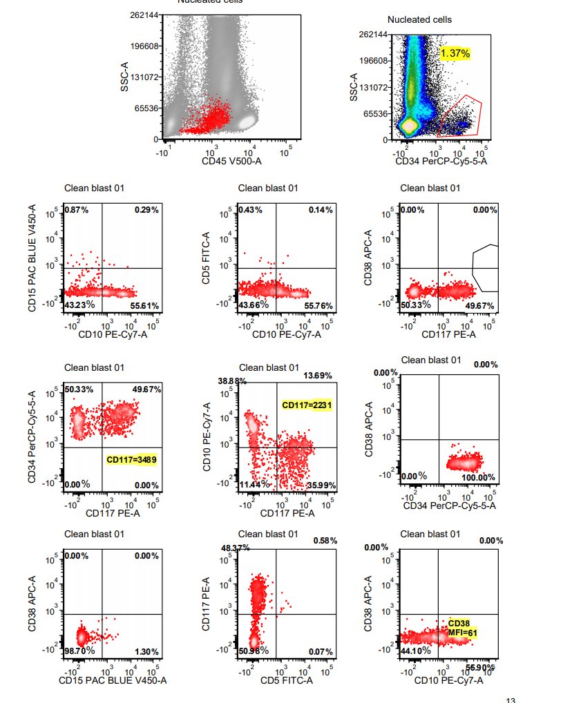 #hemepath quiz time: Flow Cytometry work up 4 therapy-related MDS... can you tell me what the patient’s primary cancer was? And what is going on here?? No poll b/c it would give the answer away. I’ll post answer tomorrow. Feel free to comment #hemepathMDA #FlowEdu