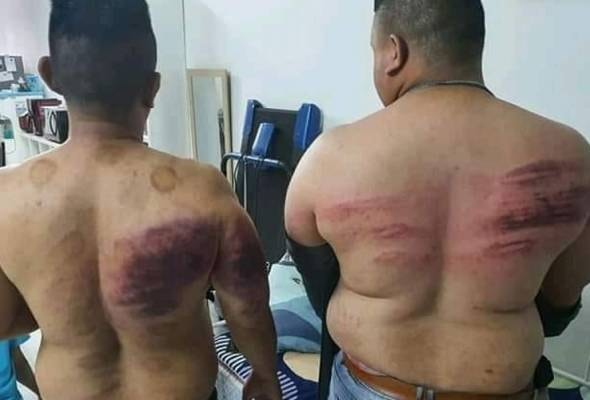 Polis Klang Selatan menahan empat individu, yang disyaki terlibat dengan kejadian berkaitan dua pekerja lelaki yang telah dipukul secara bergilir, kerana berpuasa.

Gambar awam