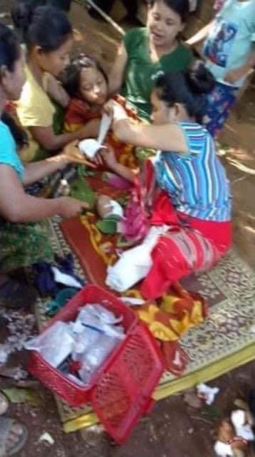 11 years old girl was badly Injured due to Junta's terrorists attack from the airstrikes. All innocent children, elders and civilians died because of SAC terrorists attacking with airstrikes. Please establish #NoFlyZoneInMyanmar to save lives.
#WhatsHappeningInMyanmar
#Apr13Coup https://t.co/1g5wr3w5Qd