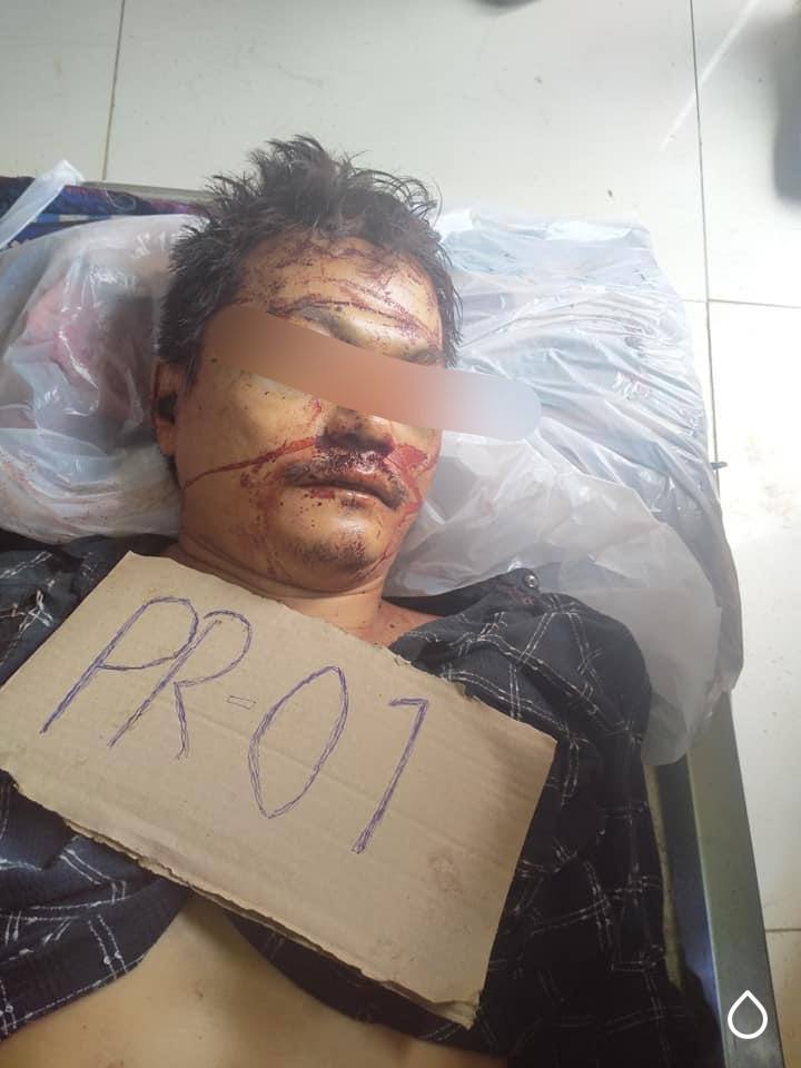 A civilian was killed brutally by Junta(SAC) and contact his family to take back the dead body today morning and lie that the civilian was died by motorcycle accident.
#Apr13Coup #WhatsHappeningInMyanmar #NoFlyZoneInMyanmar