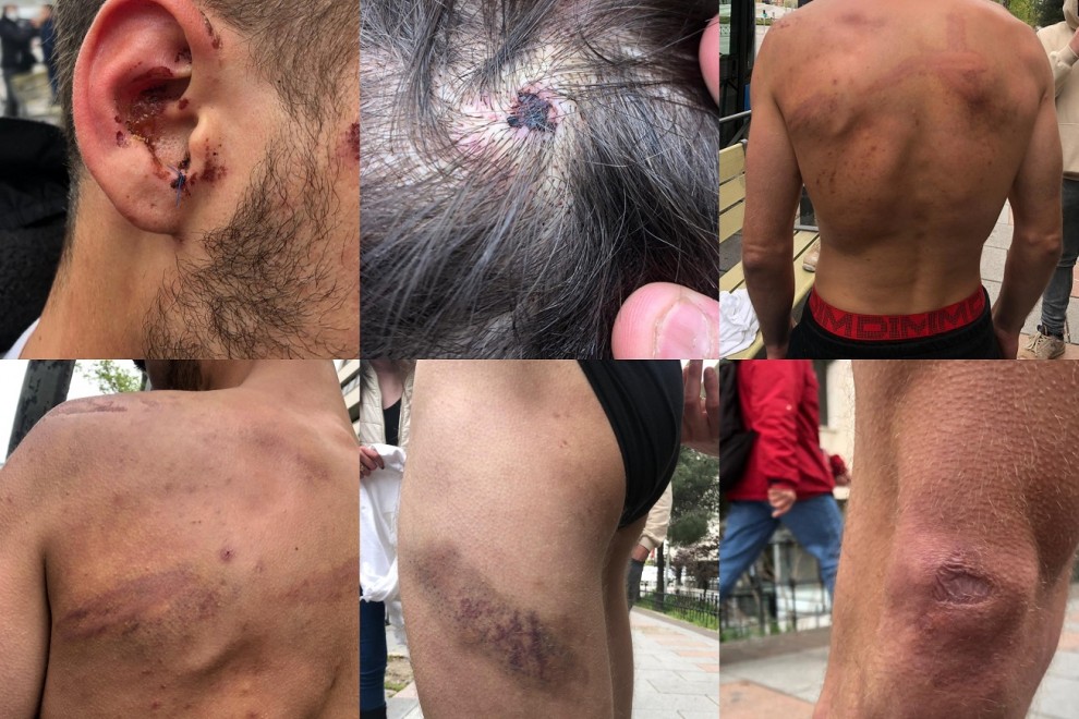 Uno de los detenidos en Vallecas denunció torturas en comisaría y en los juzgados, con partes médicos que acreditaban cómo entró y cómo salió. 

La prensa no solo calla ante esto. Ahora, algunos medios se dedican también a humillar a los detenidos: "Lloró en los calabozos".