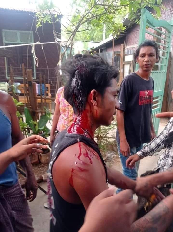 #WhatsHappeningInMyanmar #Apr13Coup #savemyanmarfrommilitarycoup At least 5 people were shot dead. In Myit Nge, Mandalay city of Myanmar. https://t.co/lhS52HwMJJ https://t.co/uIum00SnCc