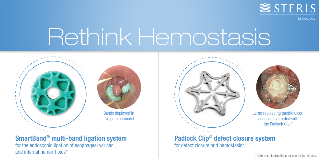 progresivo Federal Plantando árboles padlock clip mago Montaña Pogo