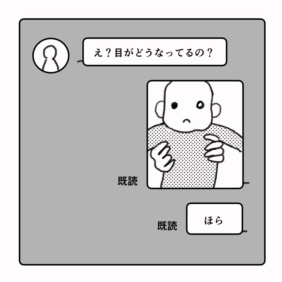 息子の目に障害が見つかった話③
#弱視 #先天性白内障 