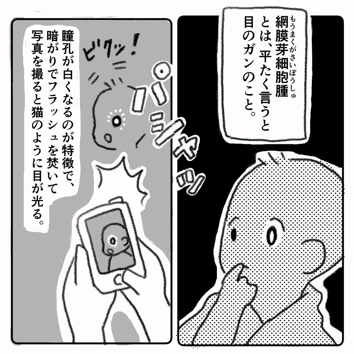 息子の目に障害が見つかった話④
#弱視 #先天性白内障 