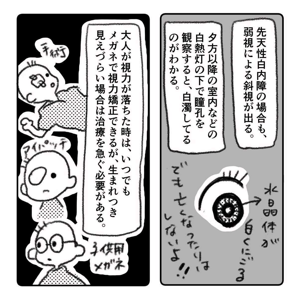 息子の目に障害が見つかった話④
#弱視 #先天性白内障 