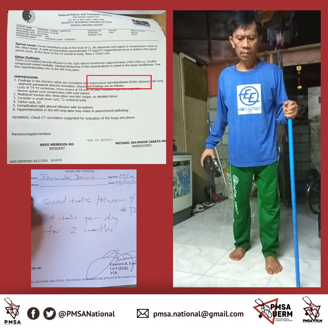 PMSANational's tweet photo. TULONG PARA KAY TATAY DENNIS

Humihingi ng tulong ang PMSA para kay Tatay Dennis Parandas.  Siya ay residente ng Pook Malinis, isang komunidad ng maralitang lungsod sa Diliman. Noong nakaraang linggo ay nadiagnose siya ng Pott's disease na sakit sa spine dahil sa tuberculosis. https://t.co/kSPvGwbyM5