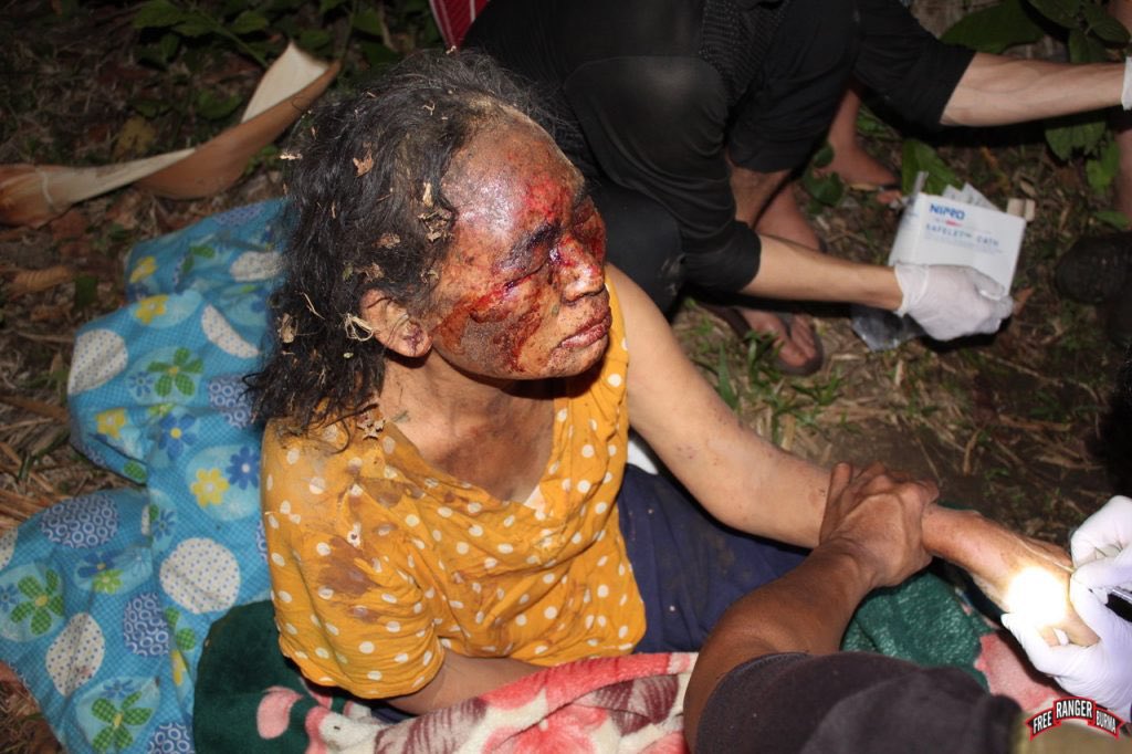 Lkwu00's tweet photo. @UN_HRC @mbachelet People's lives matter.
Media blackout, Internet shutdown, Over 700 casualties with 3000 detainees with death sentences.
How're we coping with cruelty of massacres? At least think of it?
@UN is the sole solution for the democracy revival.
We're out of options but pray? https://t.co/ZGNoeTX3An