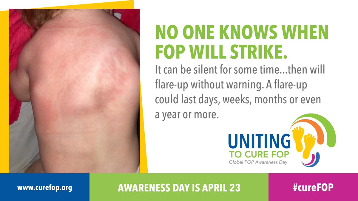 Flare-ups are not only painful, they take an emotional toll on both the person living with FOP and their family. You don't know if the flare-up will disappear or will leave new bone growth or a permanent loss of mobility. #cureFOP #RareDisease