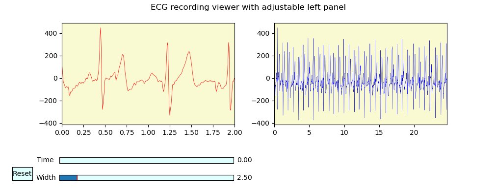 Visualization of ECG recordings using Python program ECG-pyview

The video demonstrates a testing run of the Python software visualizing ECG recordings; interesting for biosignal researchers, MDs, and users of sport testers. A snapshot is shown too.

researchgate.net/publication/35…