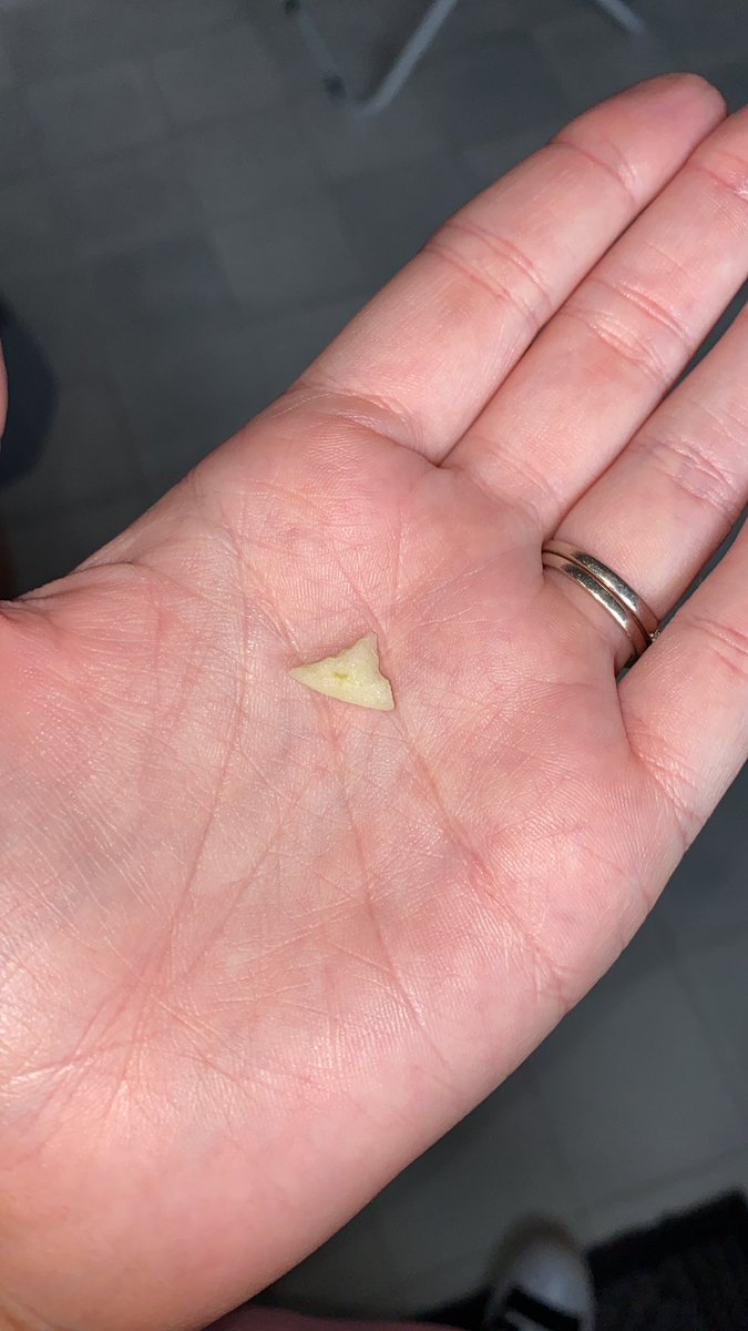 megansmallx's tweet photo. Me &amp; Kane have spent the last 2 hours trying to remove bits of apple from Harrys nostril 🙃 How’s your Tuesday?? 😅 https://t.co/PBbfk3QN7R