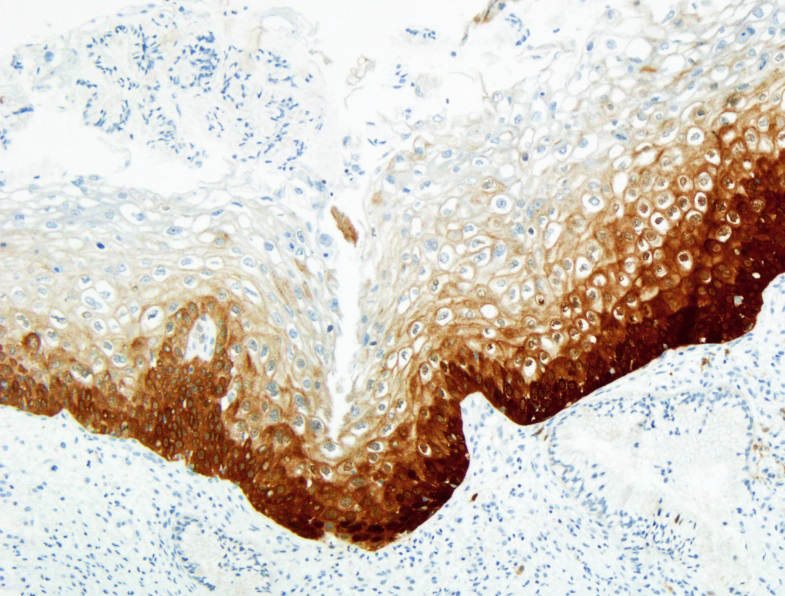 RocheDiaUSA's tweet photo. Are you ready for another #TweetorialTuesday?
Be sure to follow along at the top of each hour starting at noon.
#IHCPath #cervicalcancer #RocheMSA https://t.co/drUedVdWf9