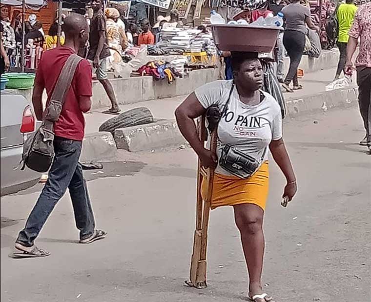 Lagos State Government has taken over the welfare of the  amputee mother who hawks to survive