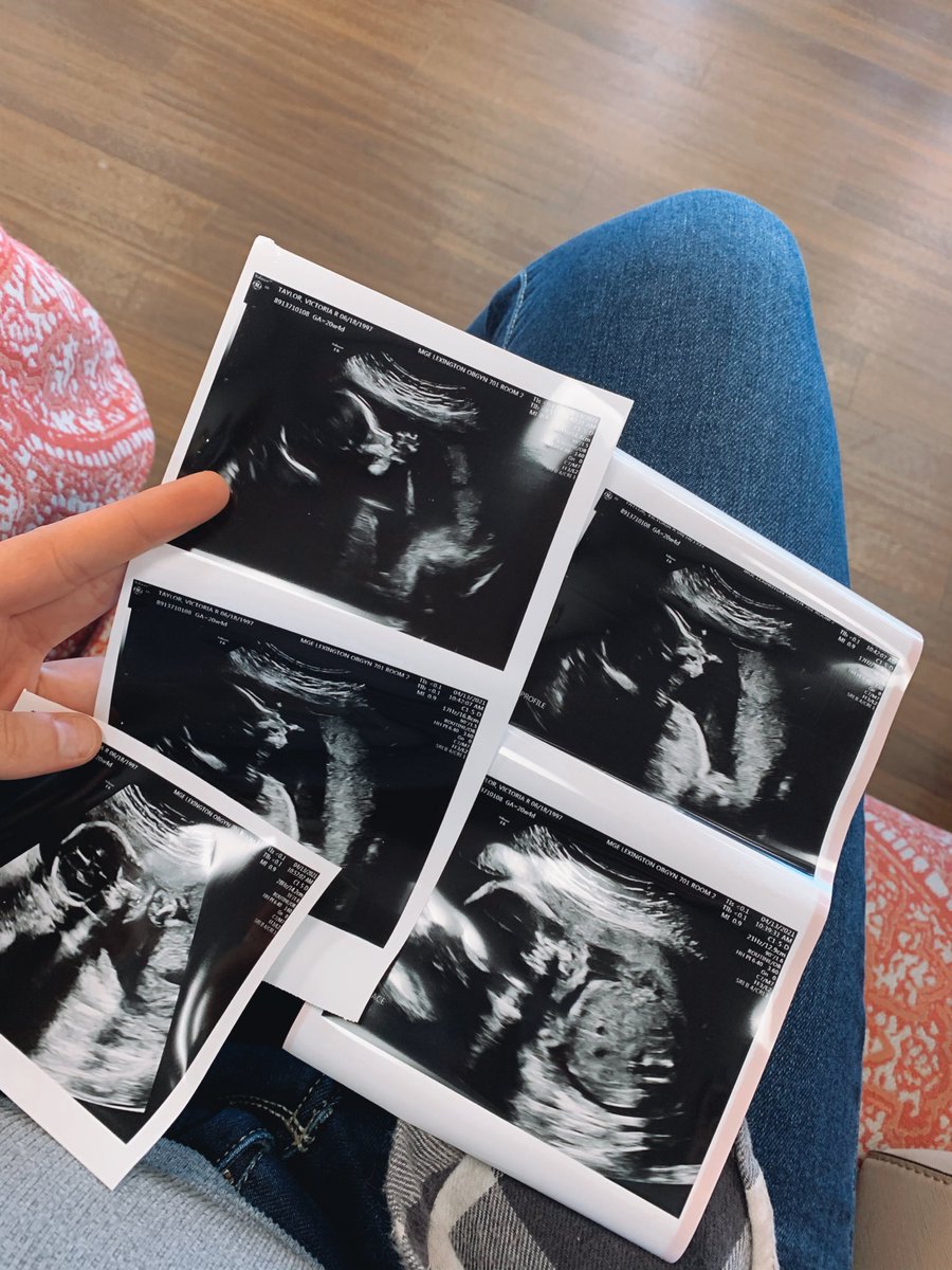 torit15's tweet image. my little bean sucking his/her thumb🥺🤍