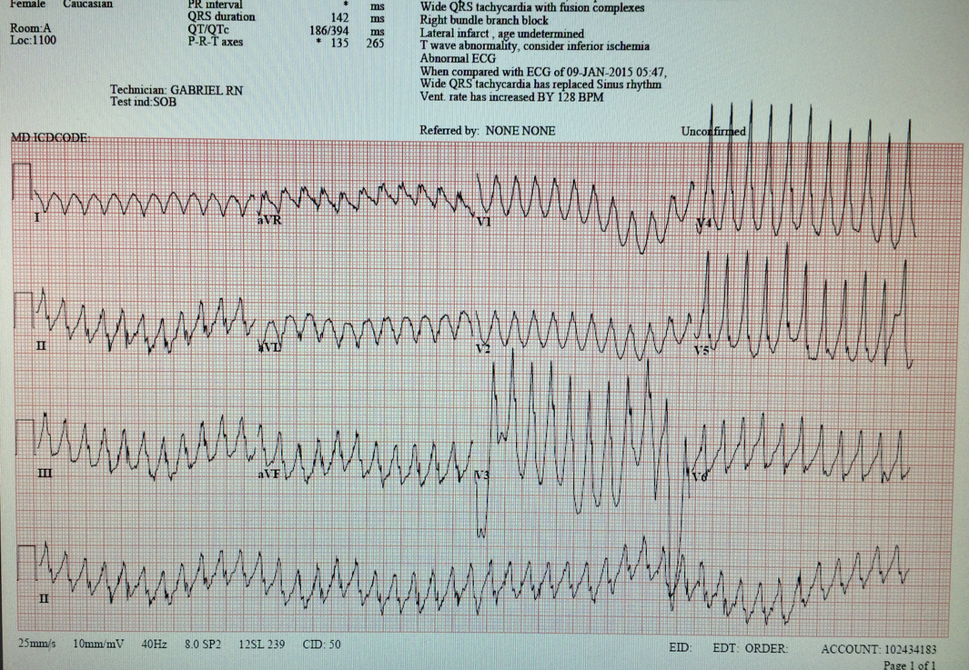 Do you recommend a defibrillator? (Reposted ECG) HR 270 bpm.