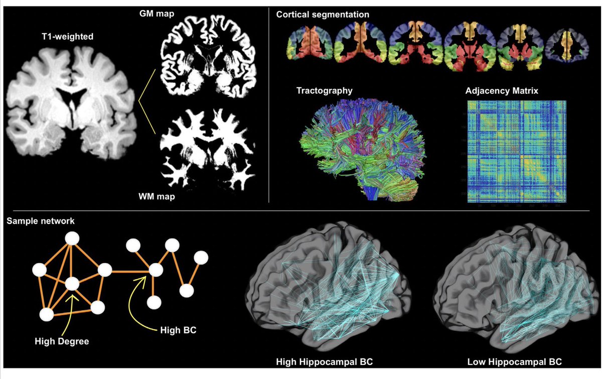 Mark your calendar for this excellent talk on temporal lobe epilepsy by Dr Zeke Gleichgerrcht! Join us with Webex link: protect-us.mimecast.com/s/eF33CQWmDrfk… #CCepiGR #epilepsysurgery <a href="/AMoosaMD/">Ahsan Moosa Naduvil, MD 🧠⚡️</a> <a href="/imadmnajm/">Imad Najm</a> <a href="/drjesfes/">Jessica Fesler MD, MEd</a> <a href="/LalDennis/">Dennis Lal</a> <a href="/VineetPuniaMD/">Vineet Punia</a> <a href="/balukrishnan/">Balu Krishnan</a> <a href="/e_gleich/">Zeke Gleichgerrcht, MD, PhD, FACNS</a> <a href="/MRI_Dan/">Dan Ma</a> @bonilha_lab