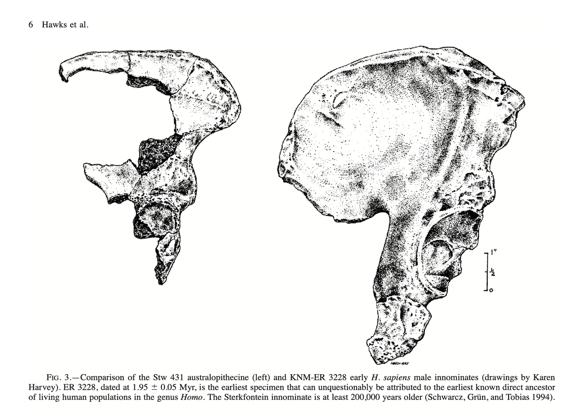 The bone was an important one in my own thinking at the turn of the millennium, as a sign that H. erectus represented a new body size niche for Homo compared to Australopithecus. That's a piece of thinking that has changed a lot in 20 years.  https://doi.org/10.1093/oxfordjournals.molbev.a026233