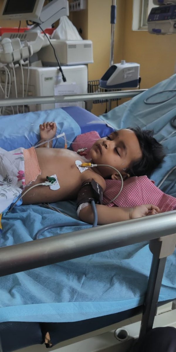 VINNURPS's tweet photo. Please Help 🙏🙏🙏
My friends daughter Rudhira is suffering from AKI Stage 3(kidney failure)
colitis 
hypertension
Covid-19
Maleria falciparam
8885755878 ph pay g pay
A/C NO:62504915266
SBIN0020655
Duggondi
@KTRTRS @RaoKavitha @trsharish @Eatala_Rajender @trspartyonline https://t.co/4BsKD8Nb9x