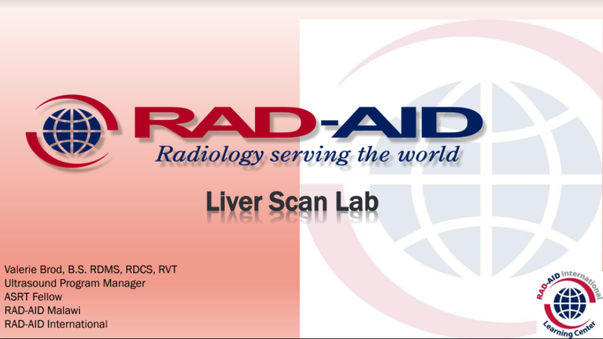 We thank Val Brod for her continued dedication and support to her peers in Malawi. The RAD-AID Malawi Program has been providing a comprehensive and structured #ultrasound course designed for its partners. Learn about RAD-AID Malawi at rad-aid.org/countries/afri…
