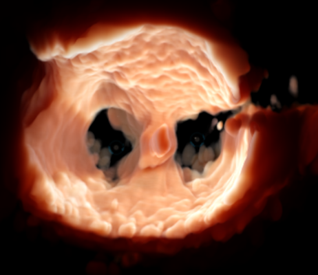 DSaetre's tweet photo. @GEHealthcare is sponsoring a Call for Research Proposals contest focused on echocardiography for #StructuralHeart interventions. Visit our challenge website to learn more https://t.co/HKRMXzS4bG   #VividResearch #EchoFirst #3Decho #cardiology https://t.co/5g81Ofijl4