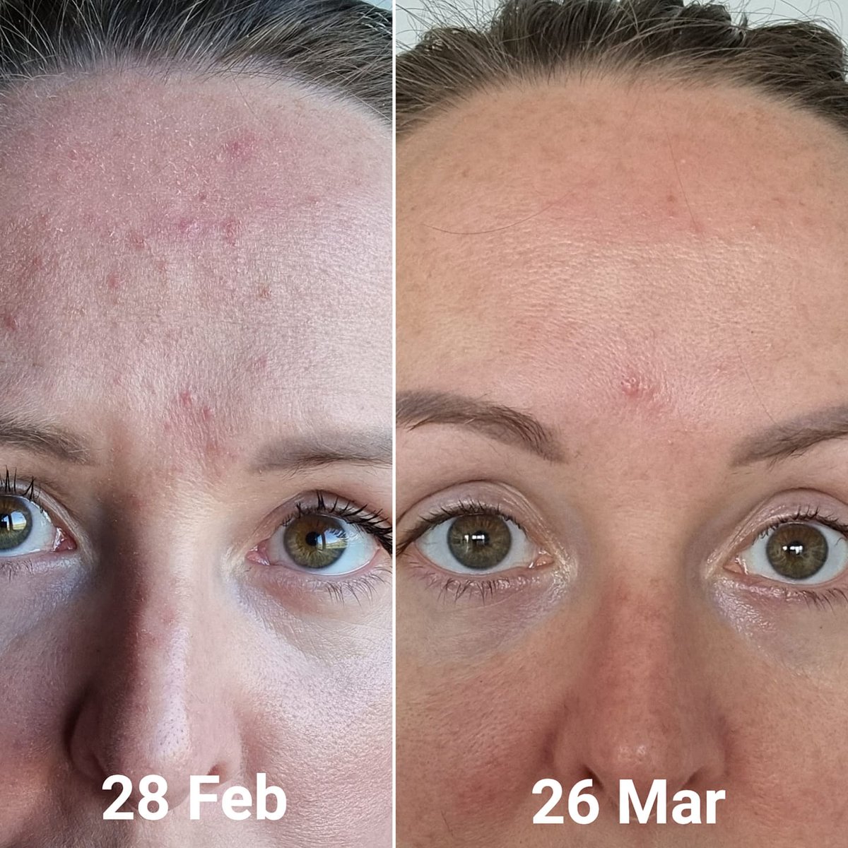 [Reposting Better Quality Image] @thebomb4 's skin became smoother, less congested, soothed and glowing with radiance using: 🌟 Miracle Cleanser 🔬 The Probiotic Concentrate 🌞 Cell Revitalise Day Moisturiser 🌜 Overnight Recovery Mask
