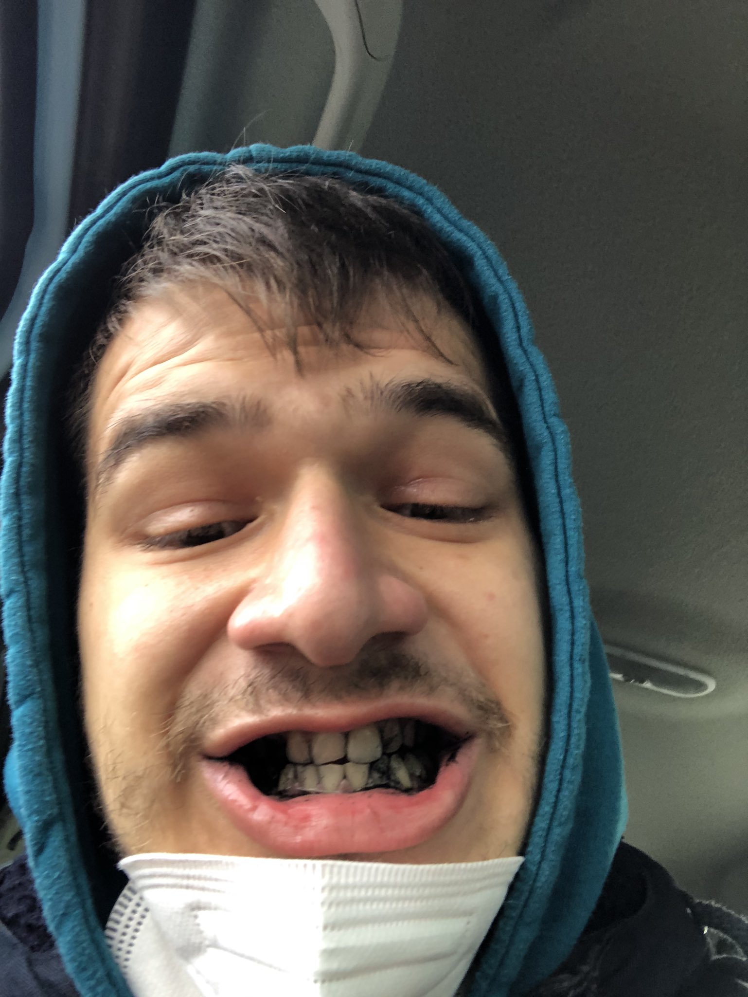 Rytmauz On Twitter Ked Spapas Cierne Uhlie Budes Ma Taketo Zubi