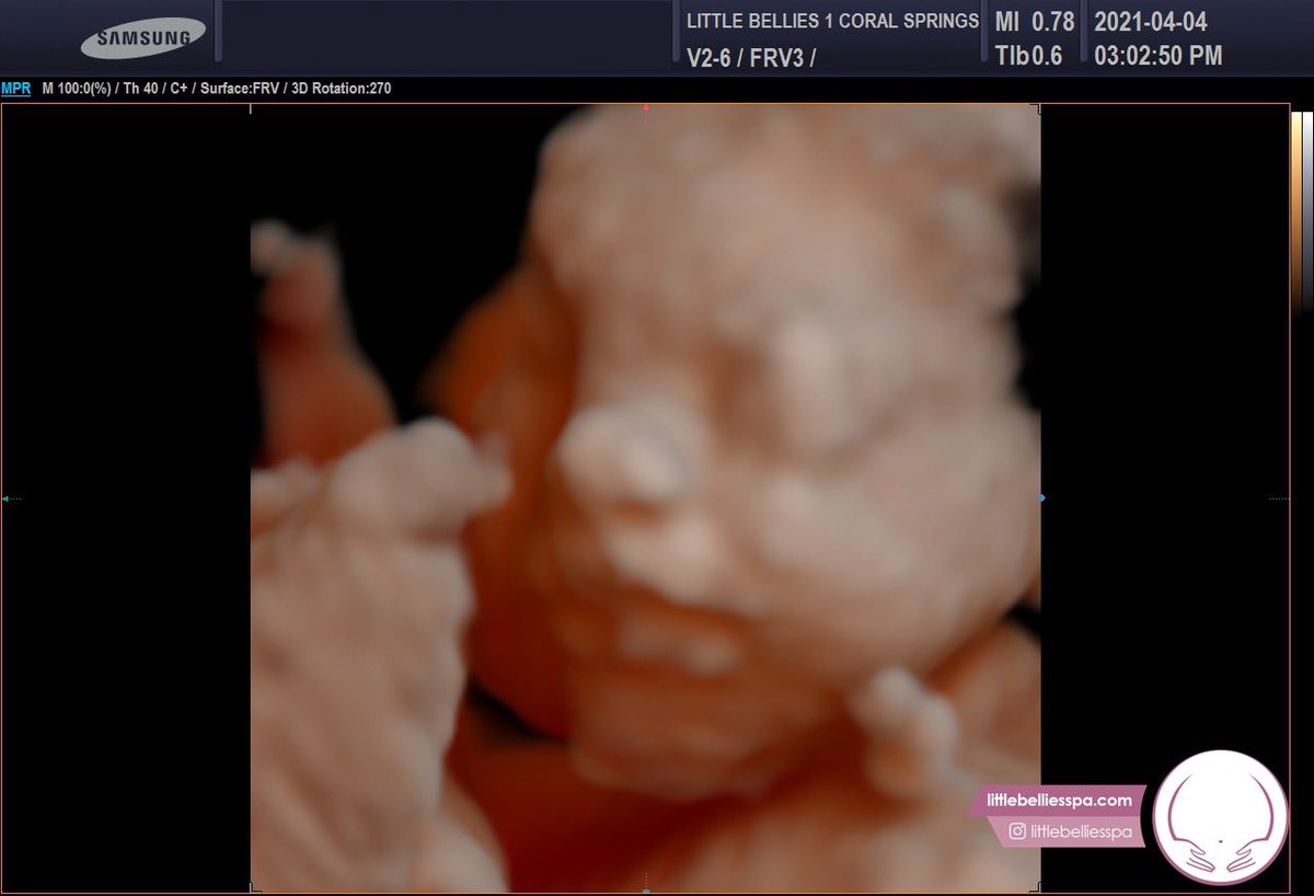 Heather Goldstein tweet media