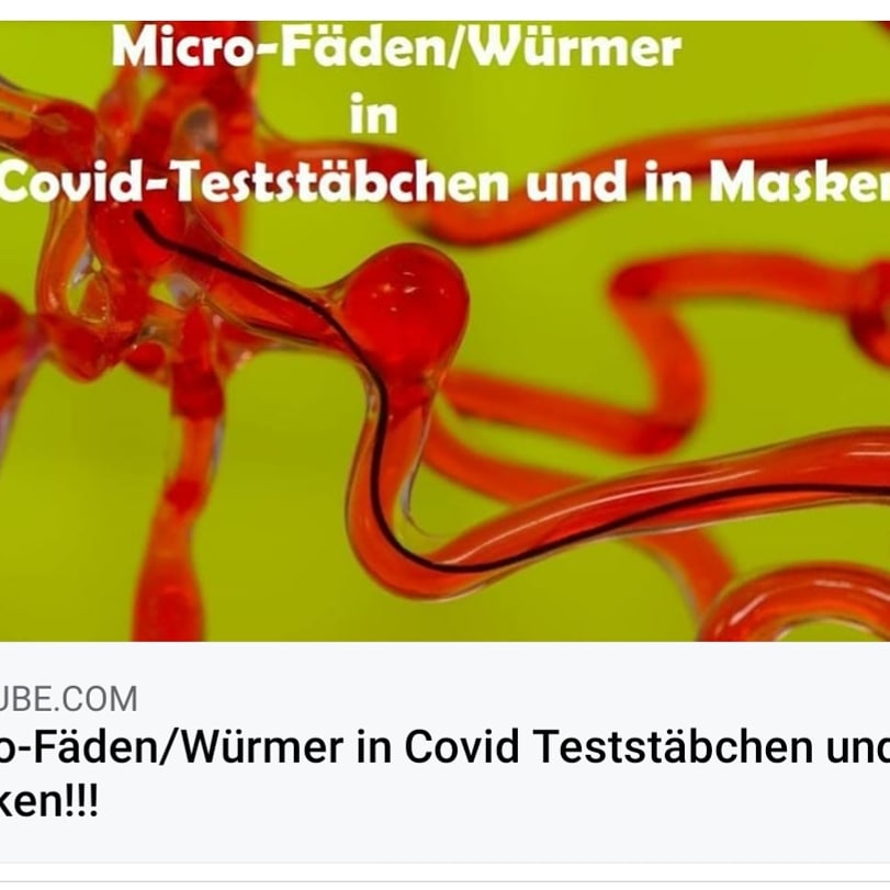 Kalimer74581639's tweet photo. @BR24 Auch im Impfstoff ist es drinn oh ja sonst wären nicht dran gestorben 130 oder mehr Tote von dem Impfstoff und 
es werden immer mehr Oh ja https://t.co/Ym9SaEQObC