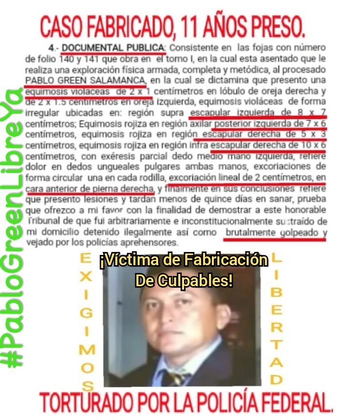 green52169's tweet photo. @lopezobrador_
@M_OlgaSCordero
@A_Encinas_R
@JesusRCuevas
ESTÉ ES EL NUM. DE RECOMENDACIÓN DONDE DETERMINO LA CNDH QUE FUE UNA INTROMISIÓN ARBITRARIA Y DETENCIÓN DE MI PAPÁ EN NUESTRO DOM.
Y EL JUEZ HIZO CASO OMISO.
#LibertadParaPabloGreenSalamanca https://t.co/poQBdIPQkX