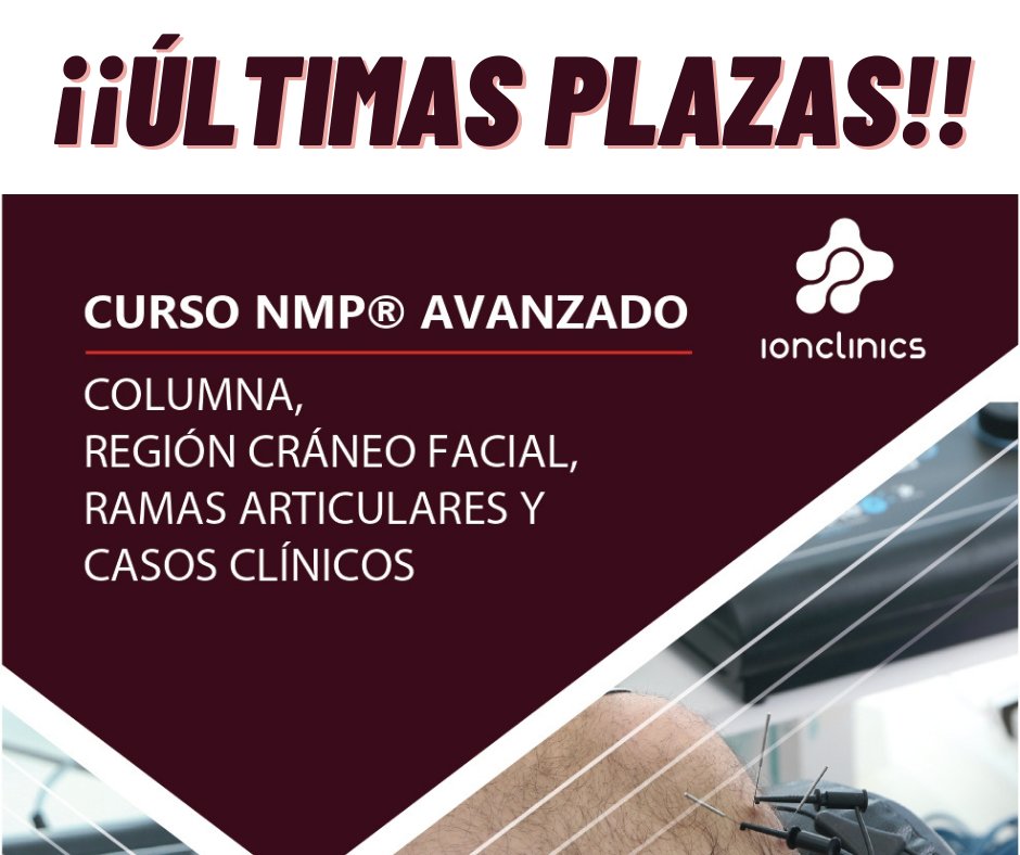 Últimas plazas para el Curso #NMP Avanzado💥

7 y 8 de mayo de 2021

Con los profesores <a href="/FranOrtegaNMP/">Francisco Ortega</a> y <a href="/ValdesusoNMP/">Raúl Valdesuso</a> 

¡Apúntate ya, que se acaban!

bit.ly/CursoNMPAvanza…

#EPTE #NeuromodulaciónPercutánea