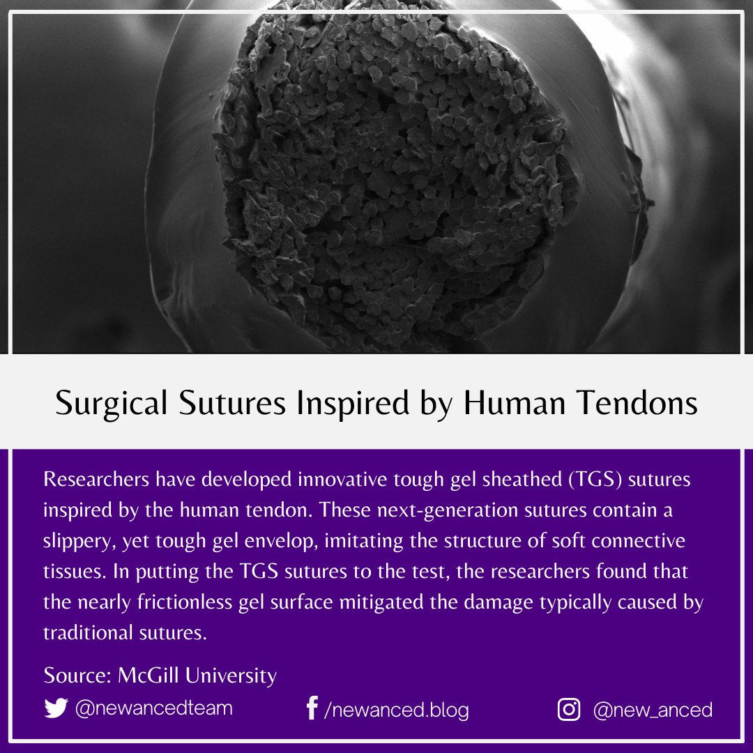 sciencenstuf's tweet photo. Surgical Sutures Inspired by Human Tendons

Source: McGill University

📷 Zhenwei Ma, McGill University.

#health #news #surgicalsutures #humantendons #toughgel #connectivetissues #damage #frictionlessgel #postsurgery #mcgilluniversity

https://t.co/YAJNi6JJVM https://t.co/7rzOWXYMRF