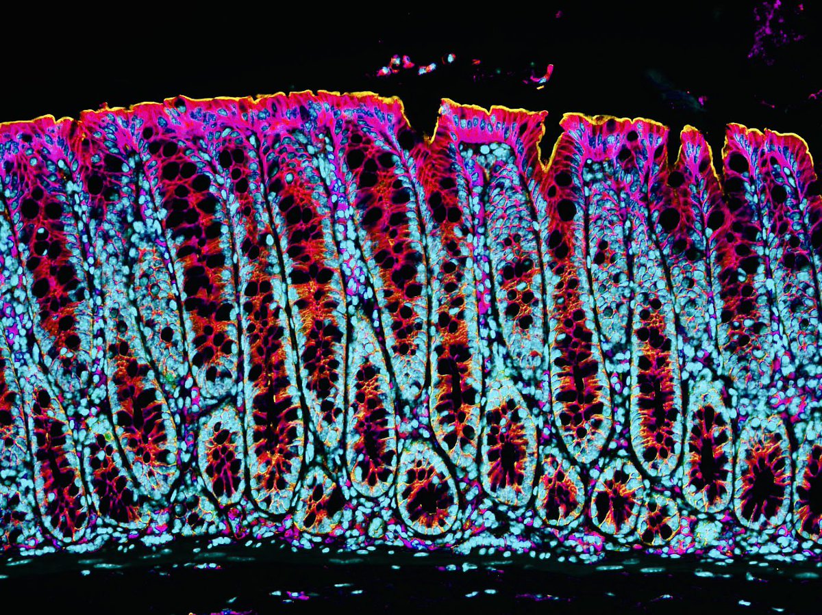 Mindy Engevik (@micromindy) on Twitter photo Love seeing all of the #FluorescenceFriday posts especially from #MUSC <a href="/sciencekelso/">Kelsey S. Moore, PhD🔬</a> <a href="/rachinstem/">Rachel Biggs</a> <a href="/CortDoesScience/">Cortney Gensemer, PhD</a> <a href="/AmyEngevik/">Amy Engevik</a> #womeninstem Love seeing all of the #FluorescenceFriday posts especially from #MUSC <a href="/sciencekelso/">Kelsey S. Moore, PhD🔬</a> <a href="/rachinstem/">Rachel Biggs</a> <a href="/CortDoesScience/">Cortney Gensemer, PhD</a> <a href="/AmyEngevik/">Amy Engevik</a> #womeninstem
