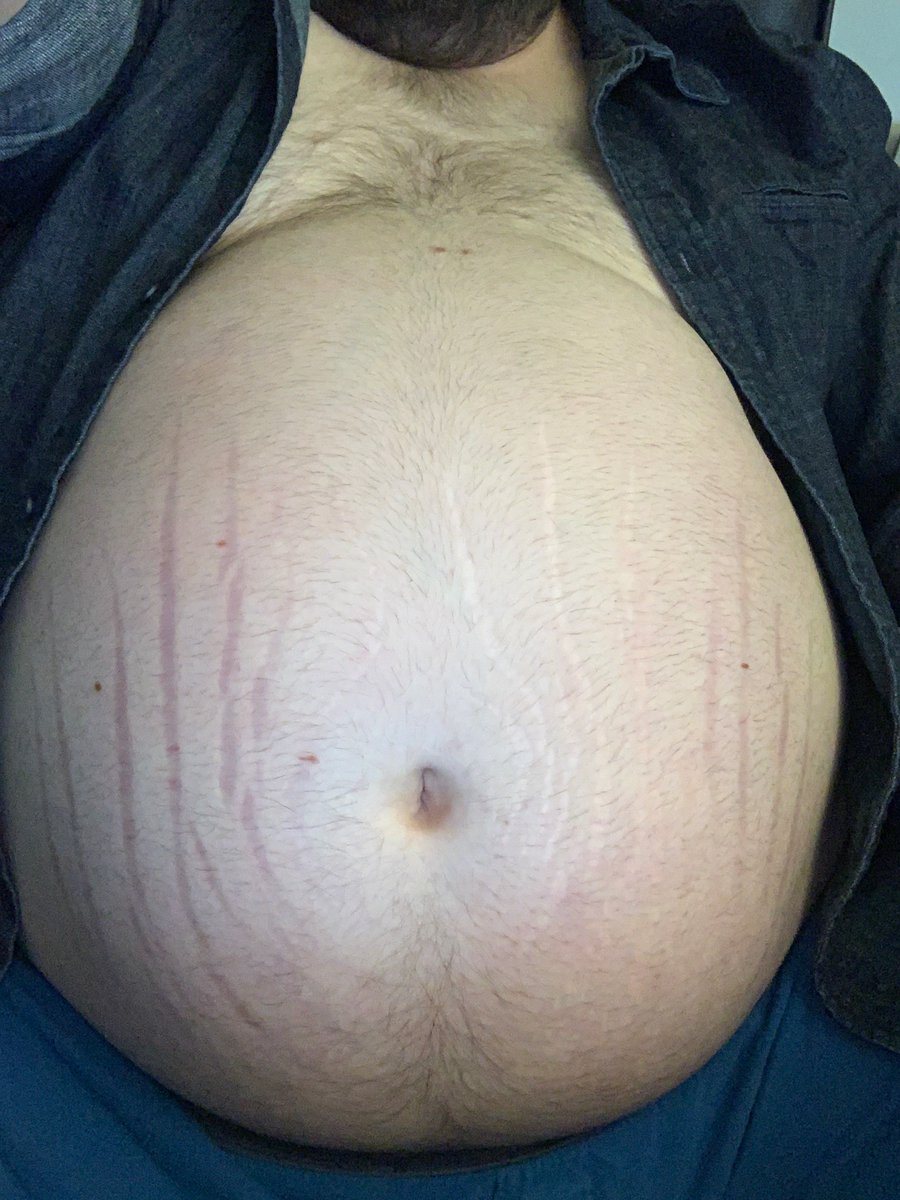 irishjuke's tweet photo. *HIC* the Kim Kardashian of beer guts is backk #beerguts #beergut #bloated #bellyfat #bloaters https://t.co/mMH03gSqf9