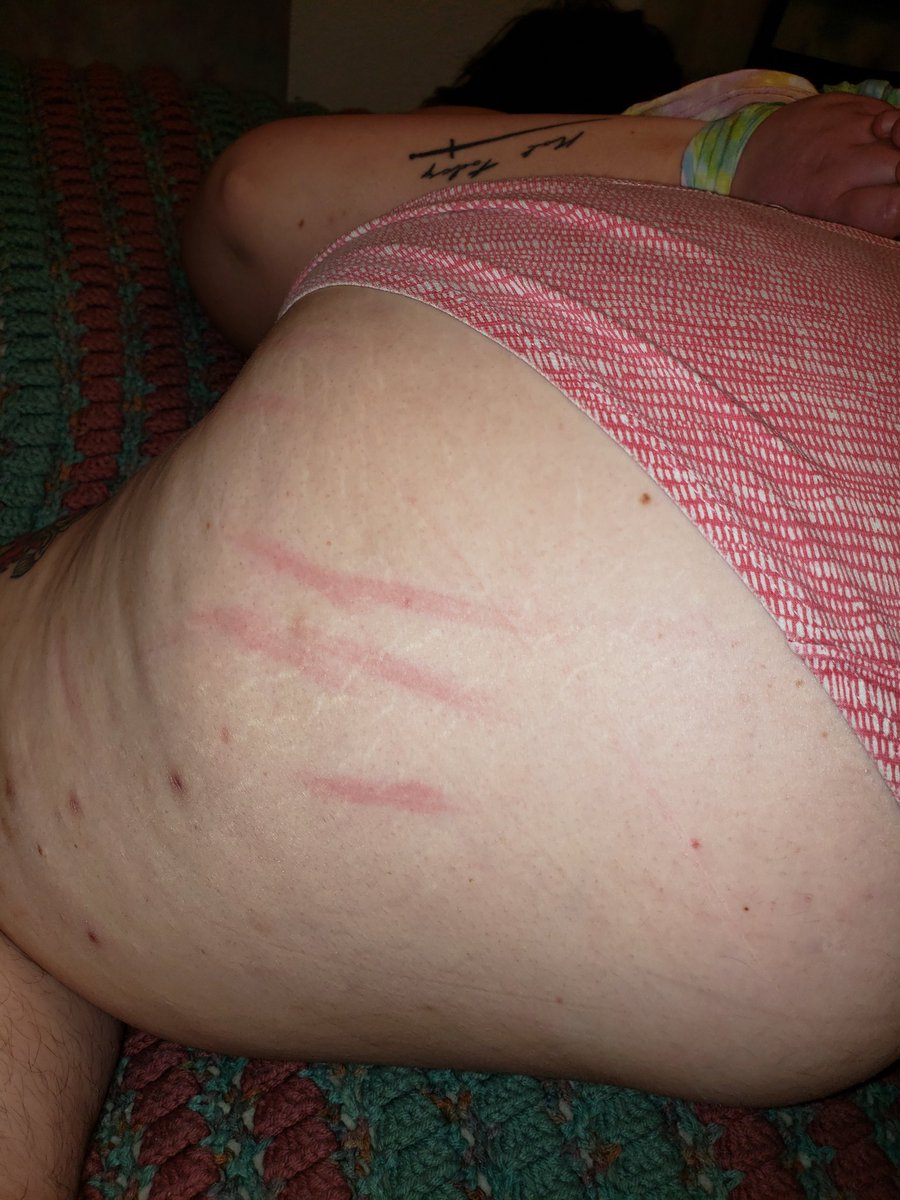 BookishChow's tweet photo. Got caned for the first time (with a cannabis stalk!) after being taken to the cemetery and am truly living my best life 🖤 my partner said "I sure gave my baby a good day" hooooweee 
#sadist #RACK #nudegoth #fatgirlsinkink #gothbdsm #impactplay https://t.co/dK8nWOgKrl