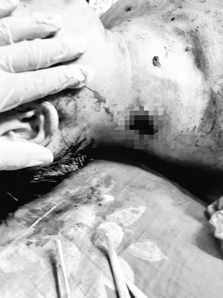 Tw // ⚠️ graphic content // death // blood // gunshot 

Two civilians were shot to the death in the head and neck in Aye YeikThar, Monywa!!!

#WhatsHappeningInMyanmar 
#Apr3Coup