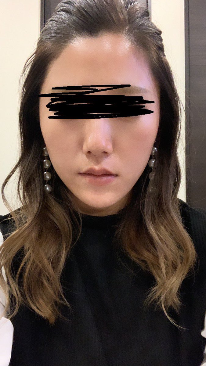 hyk29's tweet photo. 電気ばりブラシ片方だけしてみたら
口角ちょっと上がった気する https://t.co/clDZWL069x