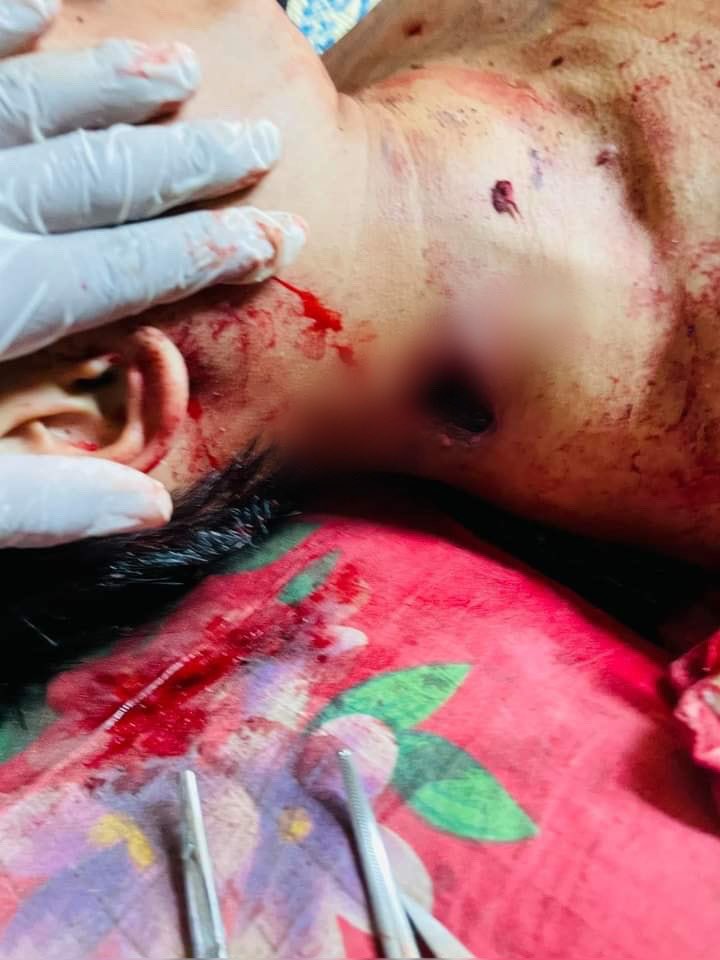 shafiur's tweet photo. #Apr3Coup Monywa

THREE killed by SAC Junta - shot in the head, shot in the neck circa 9am AND another headshot  at 1.30pm. 

#WhatsHappeningInMyanmar https://t.co/q2lD4a1gX9